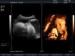 4D Color Doppler System Portable Ultrasound Scanner With High Definition LCD Monitor