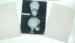 Degradable White Base Xray Paper Medical Film For Laser Printer