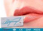 Professional Natural Reyoungel Dermal Filler Lip Enhancement Injections