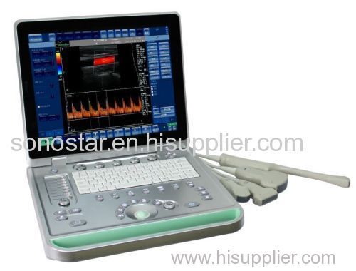 Pregnancy Scanner Ultrasound USB Ultrasound Scanner Guangzhou Manufacturer