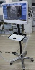 Color Doppler Ultrasound System Touch Screen scanner