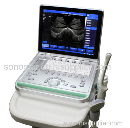 Laptop Ultrasound B scanner armed based scanner