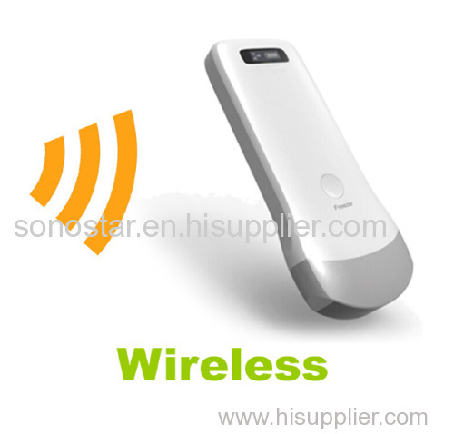 New Arrival Handheld Wireless Scanner Sonostar Scanner
