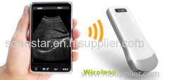 New Arrival Handheld Wireless Scanner Sonostar Scanner