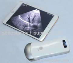 New Arrival Handheld Wireless Scanner Sonostar Scanner
