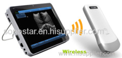 New Arrival Handheld Wireless Scanner Sonostar Scanner