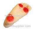 PVC Diabetic Foot Nursing simulator of foot pathological changes caused by diabetes