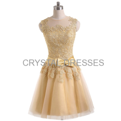 ALBIZIA Gold Lace Short Prom Gown Tulle Bridal Cocktail Dresses for Bride 2015