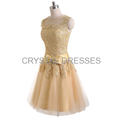 ALBIZIA Gold Lace Short Prom Gown Tulle Bridal Cocktail Dresses for Bride 2015