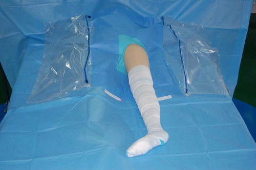 Disposable Knee Arthroscopy drape