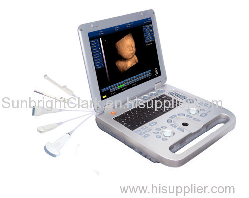 New Arrival cheap Laptop Battery 3D Ultrasound machine for pregnancy