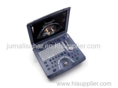 GE Voluson E Portable Ultrasound Machine With 1 Year Warranty