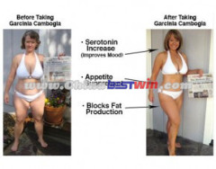 Garcinia Cambogia Extract Slimming Patches As Seen On TV