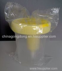 vacuum urine test container urine specimen cups