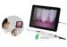 Portable Mini Endoscope Super Cam WI-FI dentist Gift Dental Oral Endoscope