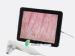 Portable LED Screen Hair detecting And Skin Analyzer Machine Without PC