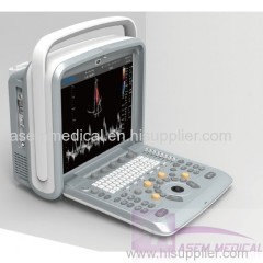 Chison Q9 Color Doppler Ultrasound Scanner