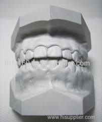 Mouth Guard Study Model