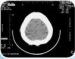 Agfa Thermal Printers Printing Digital Image Laser X Ray Film Medical Products