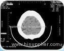 Agfa Thermal Printers Printing Digital Image Laser X Ray Film Medical Products