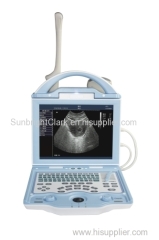 10.4 Inch LED Screen cheap Portable Ultrasound Machine Price for Pregnancy