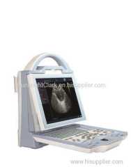 10.4 Inch LED Screen cheap Portable Ultrasound Machine Price for Pregnancy