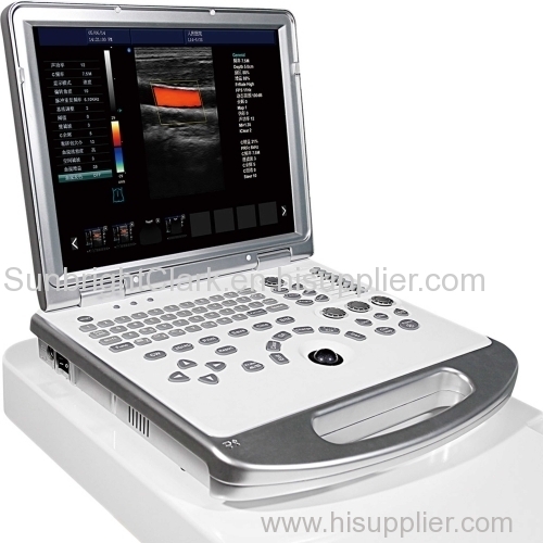 Cheap 3D laptop Color Doppler Ultrasonic Scanner/doppler ultrasound for sale