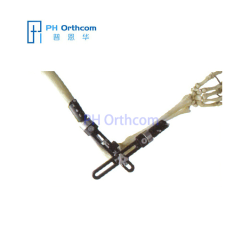 Elbow Fixator with ProCallus Straight Clamps Orthofix Type Fixator Trauma Orthopedic External Fixation Device