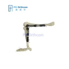 Knee Fixator with ProCallus Straight Clamps Orthofix Type External Fixator Trauma Orthopedic