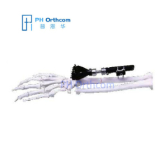 Extra-articular Radiolucent Wrist Fixator Orthofix System Trauma Orthopedic External Fixation Device