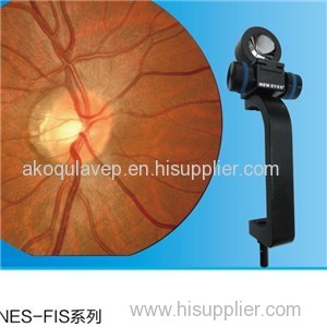 Retinal Imaging System For Slit Lamp