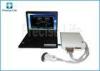 Computer base Medical Ultrasound Machine scanner with 3D image