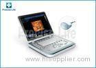 Laptop Ultrasonic Scanner Medical Ultrasound Machine With 4D Image