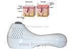 Hypopigmentation 308 nm Diode Laser System Scalp Psoriasis / Tinea Versicolor Cure