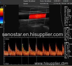 C200 Trolley Color Doppler Ultrasound B scanner