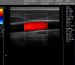 C200 Trolley Color Doppler Ultrasound B scanner