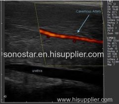 C200 Trolley Color Doppler Ultrasound B scanner