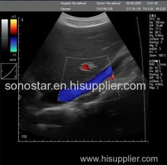 C200 Trolley Color Doppler Ultrasound B scanner