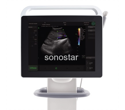 C3 Color doppler ultrasound(Touch Screen)