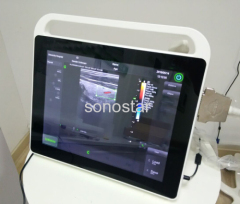 C3 Color doppler ultrasound(Touch Screen)