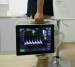 C3 Color doppler ultrasound(Touch Screen)