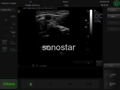 C3 Color doppler ultrasound(Touch Screen)