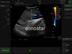 C3 Color doppler ultrasound(Touch Screen)