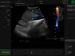 C3 Color doppler ultrasound(Touch Screen)