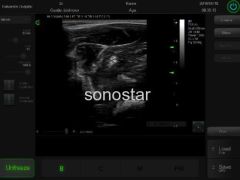 C3 Color doppler ultrasound(Touch Screen)