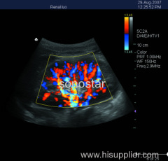 C5 Laptop Color Doppler Ultrasound (System Ultrasound Color Doppler Portable)