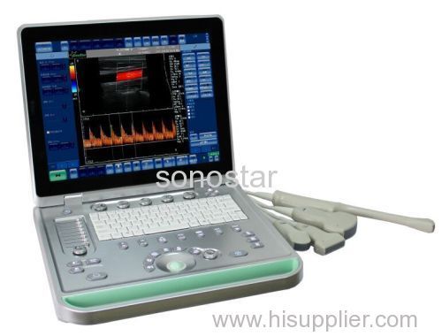 C2 Sonostar cheap doppler ultrasound mobile color doppler ultrasound machine