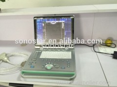 C2 Sonostar cheap doppler ultrasound mobile color doppler ultrasound machine