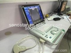 C2 Sonostar cheap doppler ultrasound mobile color doppler ultrasound machine