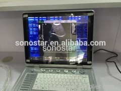 C2 Sonostar cheap doppler ultrasound mobile color doppler ultrasound machine